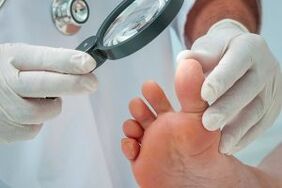 Treatment of plantar strengths