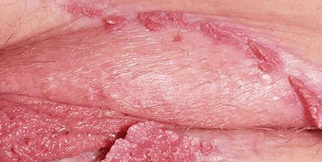 Canonoma